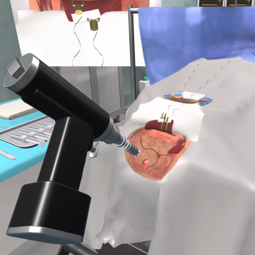 Образовательный комплекс «Виртуальная хирургическая операционная: Декомпрессионная краниотомия»