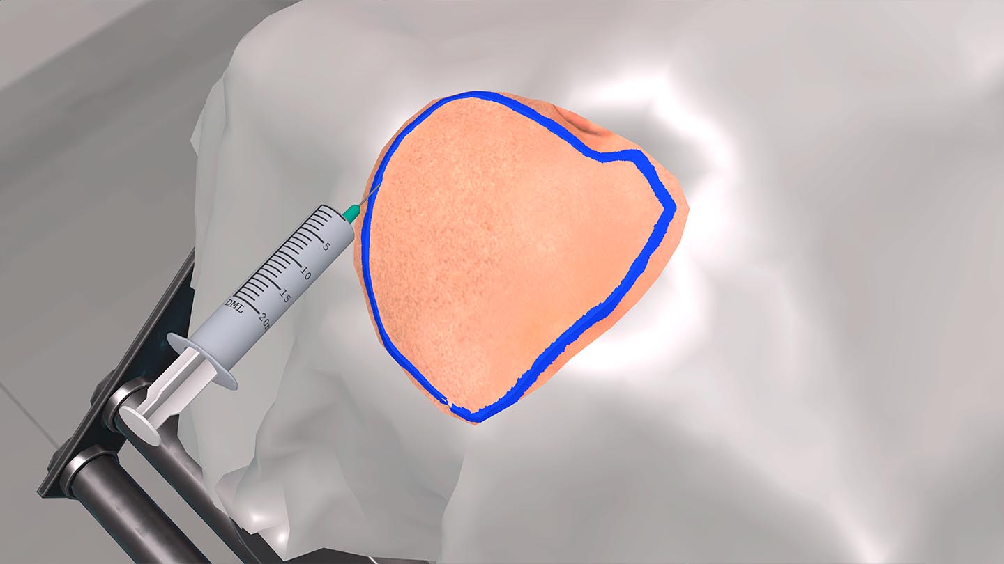 Образовательный комплекс «Виртуальная хирургическая операционная: Декомпрессионная краниотомия» Образовательный комплекс «Виртуальная хирургическая операционная: Декомпрессионная краниотомия»