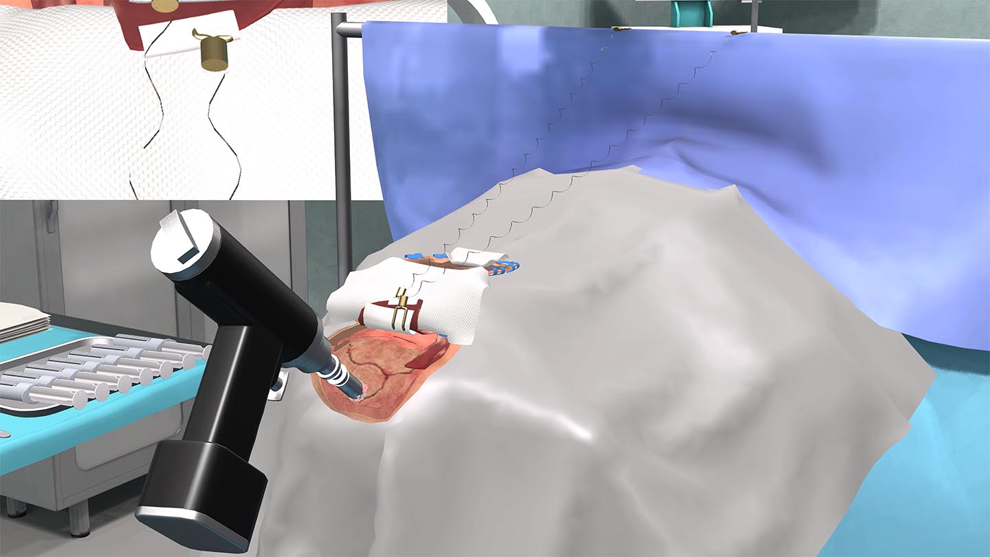 Образовательный комплекс «Виртуальная хирургическая операционная: Декомпрессионная краниотомия» Образовательный комплекс «Виртуальная хирургическая операционная: Декомпрессионная краниотомия»