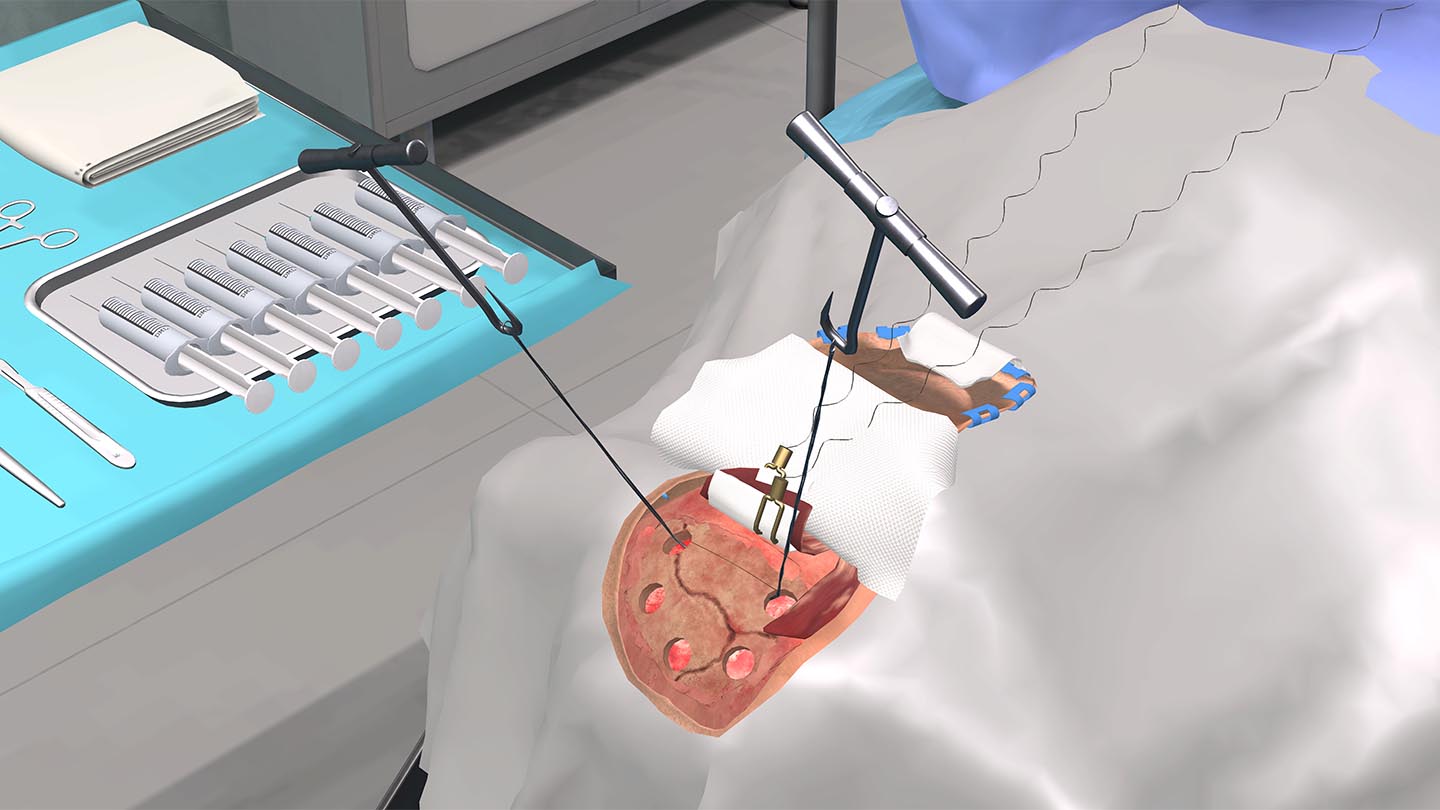Образовательный комплекс «Виртуальная хирургическая операционная: Декомпрессионная краниотомия» Образовательный комплекс «Виртуальная хирургическая операционная: Декомпрессионная краниотомия»