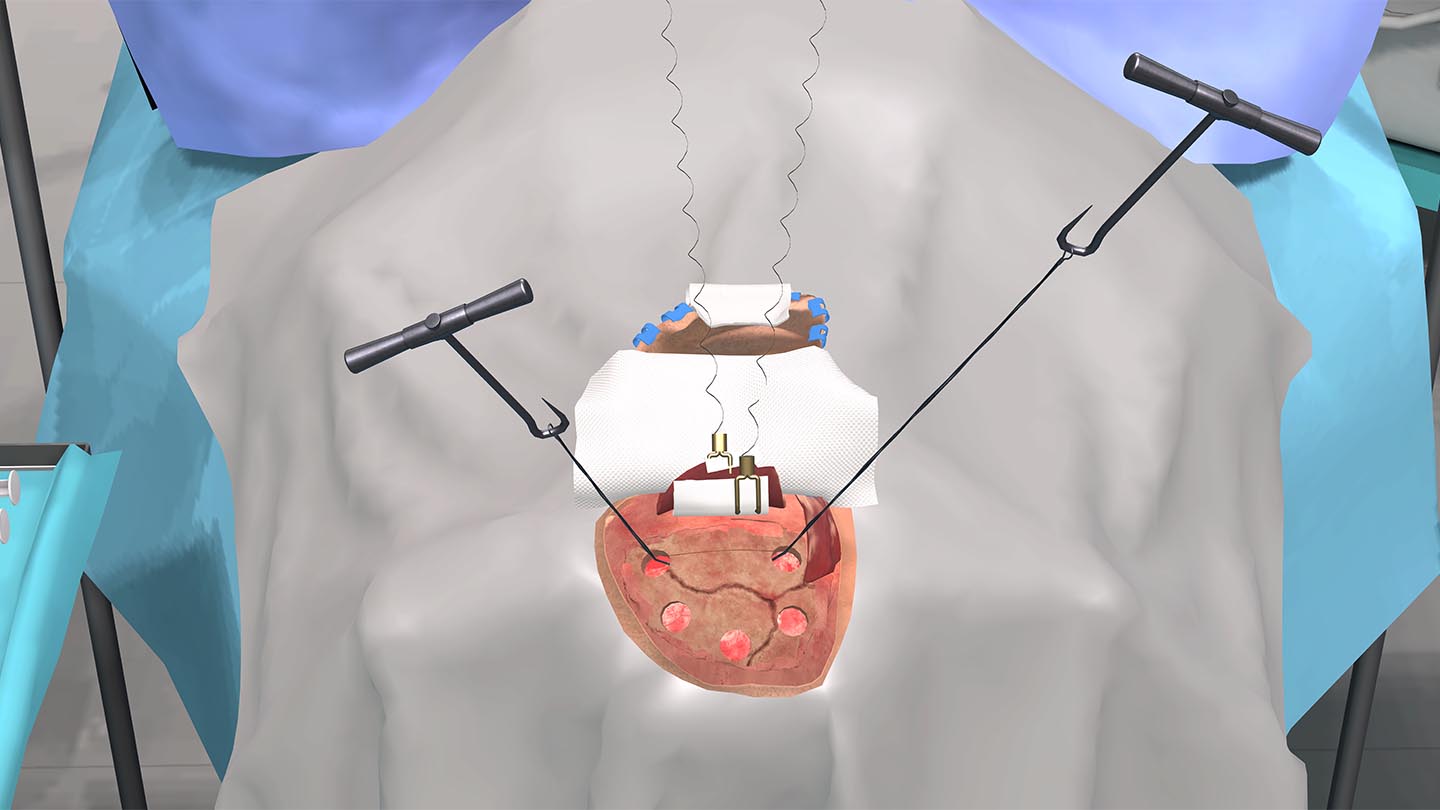 Образовательный комплекс «Виртуальная хирургическая операционная: Декомпрессионная краниотомия» Образовательный комплекс «Виртуальная хирургическая операционная: Декомпрессионная краниотомия»